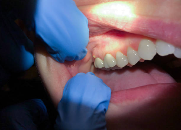 Best Weekend Emergency Dentist in Goodman, MO